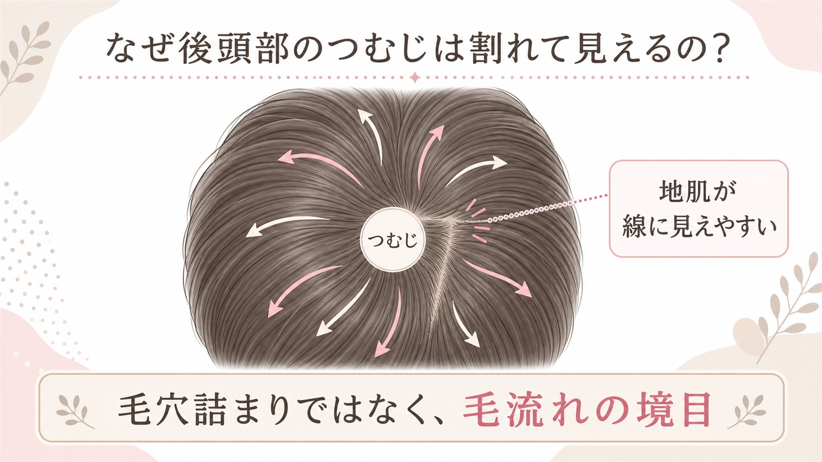 つむじの毛流れで後頭部が割れて見える仕組み