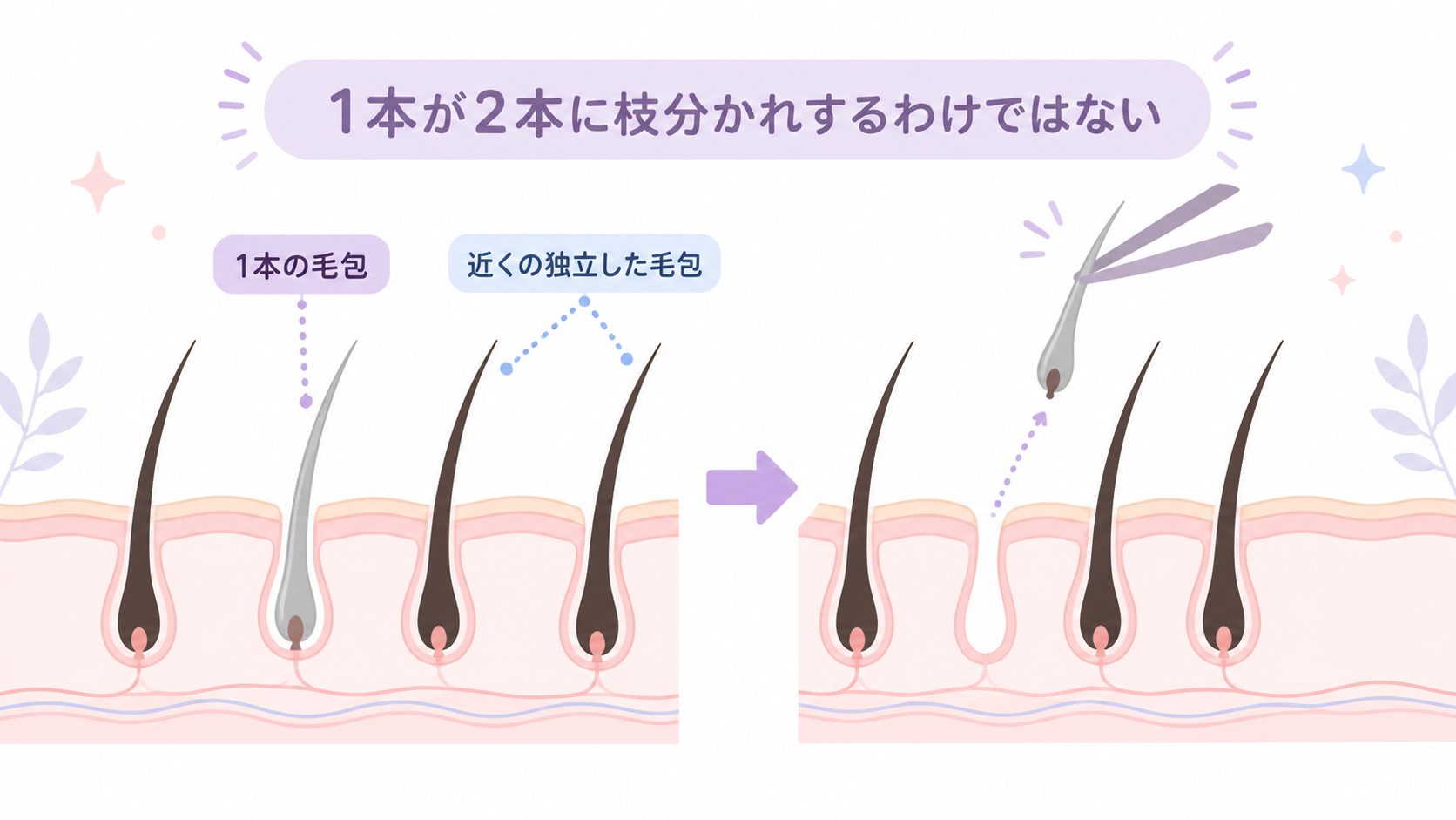 白髪を1本抜いても2本に増えない毛包の図解